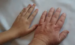 İnsan Uzuvları Yeniden Büyüyebilir Mi? Cevap Axolotl’da Gizli