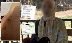 Polis Sevgilisinden Şiddet Gören Kadın: “Kurtarın Beni”