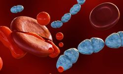 Her 5 Ölümden 1'inin Sebebi:‘Sepsis’