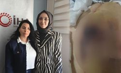 Yağ Aldırma Ameliyatı Geçirdi Hayatı Karardı