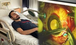 Damadını Gözünden Vurdu