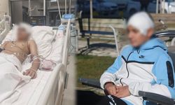 Akran Zorbalığı Hayatı Kararttı: Kafatası Titanyumla Yapıldı