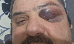 Es Turizm'in Şoförü Terminalde Dövüldü