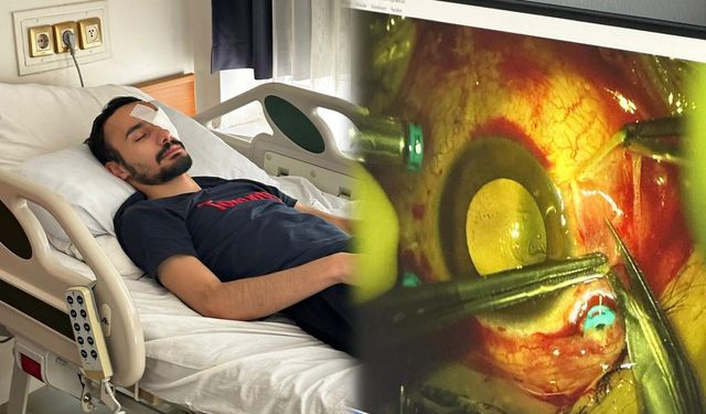 Damadını Gözünden Vurdu