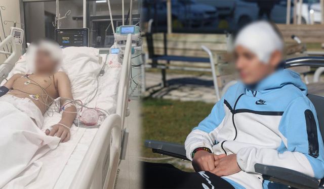 Akran Zorbalığı Hayatı Kararttı: Kafatası Titanyumla Yapıldı