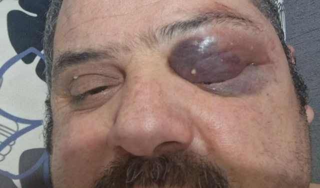 Es Turizm'in Şoförü Termanalde dövüldü