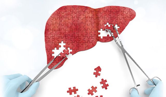 Hepatitte Erken Tanı Hayat Kurtarıyor
