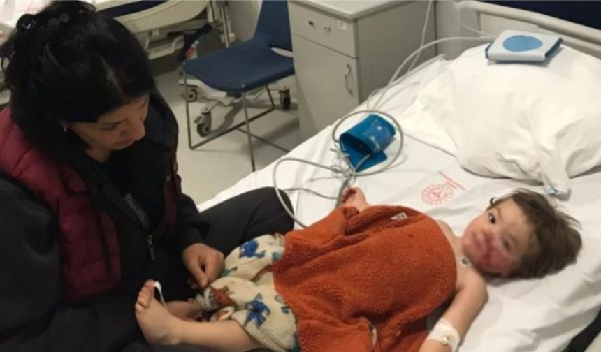 Pitbull küçük çocuğun yüzünü parçaladı